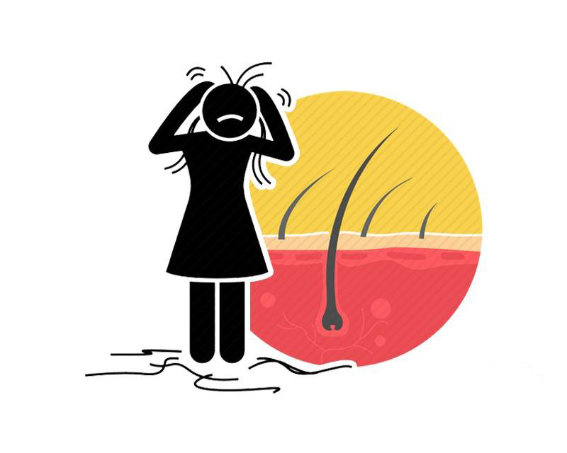 2亿中国人的“头发危机”：每天洗头，真的会加速脱发的频率？(图5)