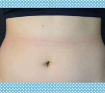 整形价格多少钱？做次整形到底需要多少钱？2022年全国整形价格表查询？双眼皮价格表？隆鼻价格表？吸脂价格表？(图14)