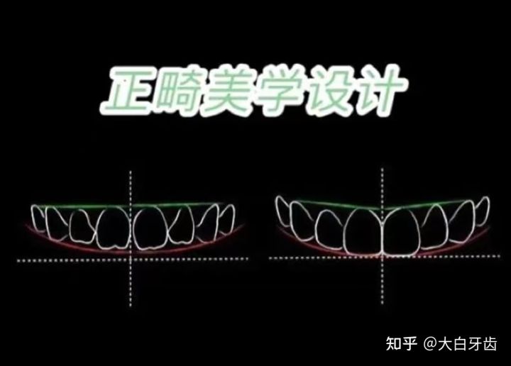 2022年成都十大牙齿矫正医院排名，成都牙齿矫正哪里性价比最高？成都牙齿矫正价格表！(图5)