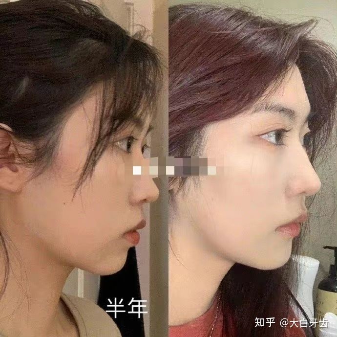 2022年成都十大牙齿矫正医院排名，成都牙齿矫正哪里性价比最高？成都牙齿矫正价格表！(图9)