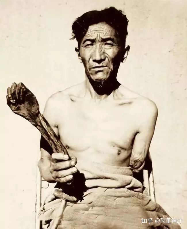 触目惊心的西藏农奴照片，悲惨生活，暗无天日！（​这组照片有点残忍，胆小者请慎入）(图1)